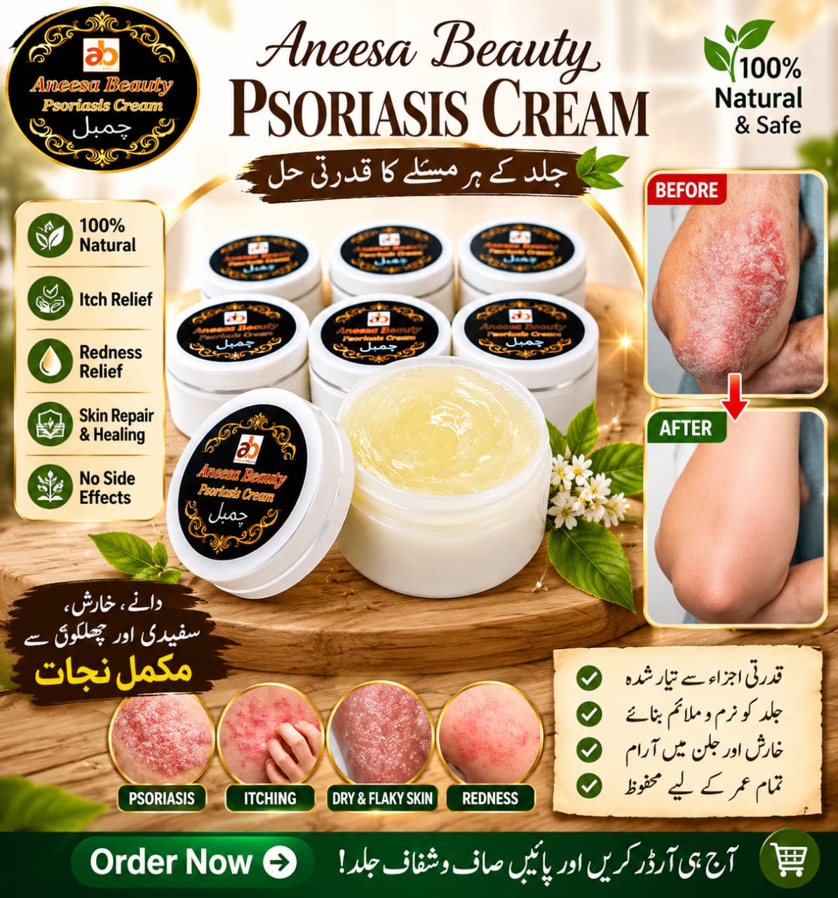 Aneezabeauty Psoriasis Cream product promotional image